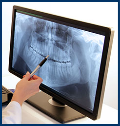 Low Radiation X-rays Oakland CA